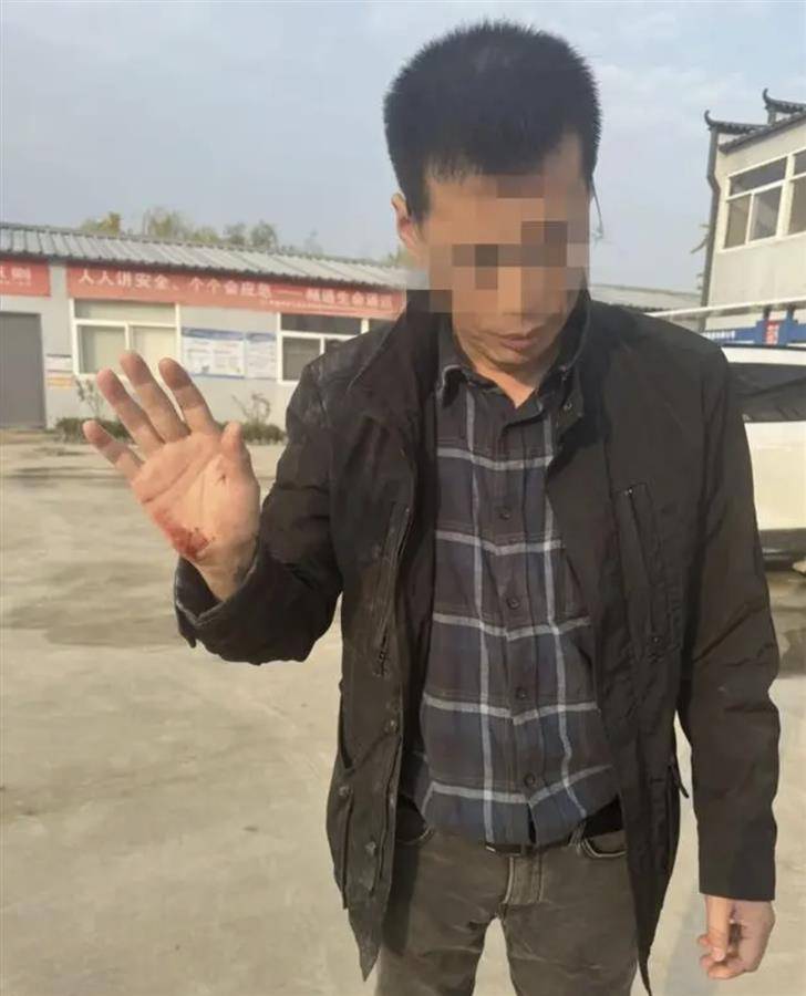 皇冠信用登2代理网址_获得8次中国新闻奖的著名调查记者被打皇冠信用登2代理网址,中铁七局回应:正配合定远警方全面调查
