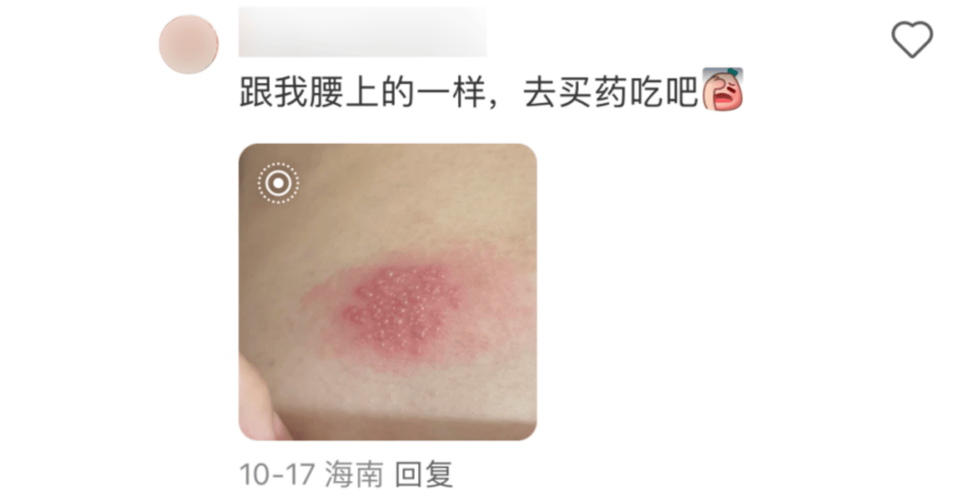 皇冠信用网会员开户_一旦感染终身携带皇冠信用网会员开户!深圳疾控提醒:这4类人要注意