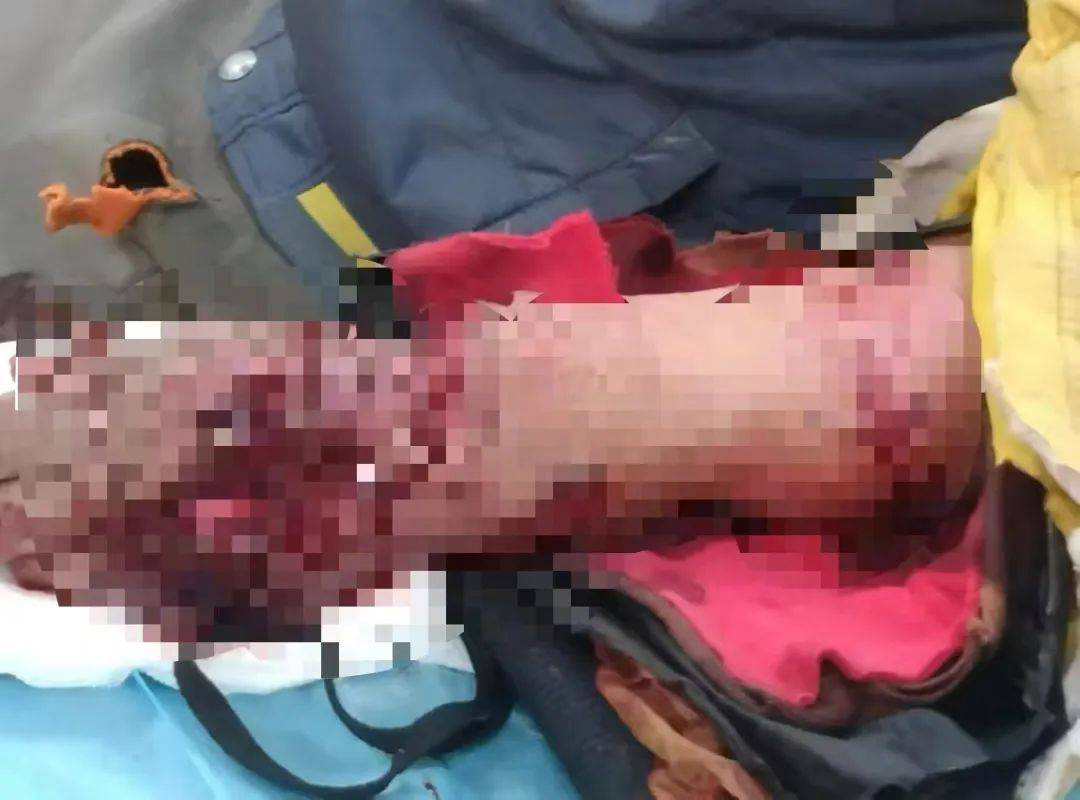 皇冠信用网怎么注册_老虎扑咬 73 岁老人撞到铁栅栏皇冠信用网怎么注册,家属:老虎咬人后欲闯我家