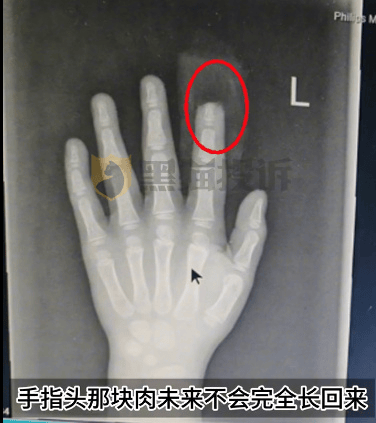 皇冠信用盘代理流程
_小鹏汽车回应“X9屏幕夹断5岁男童半节食指”