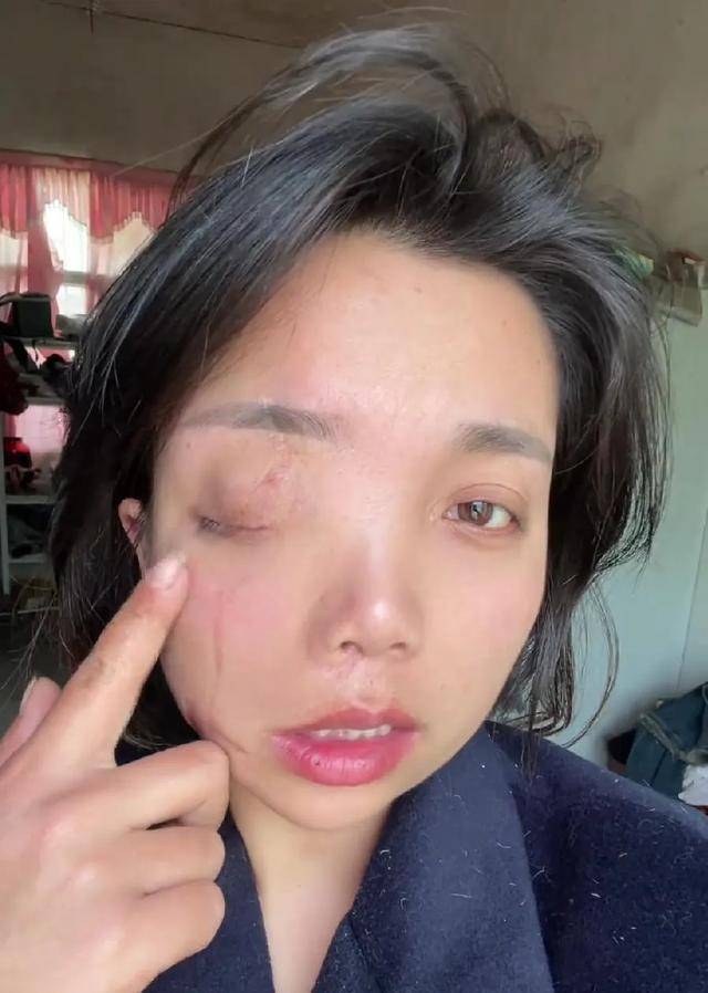 皇冠信用网在哪里开通
_安徽女子左眼失明皇冠信用网在哪里开通
,办理残疾人证被拒?残联:双眼残疾可办理