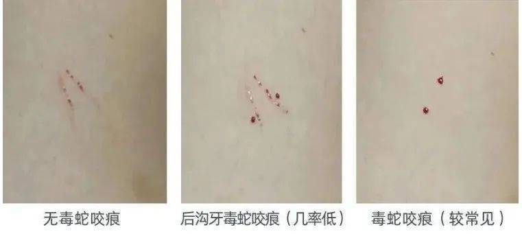 WNBA比分
_太吓人！深圳16天接警232宗！“抓不完WNBA比分
，根本抓不完……”