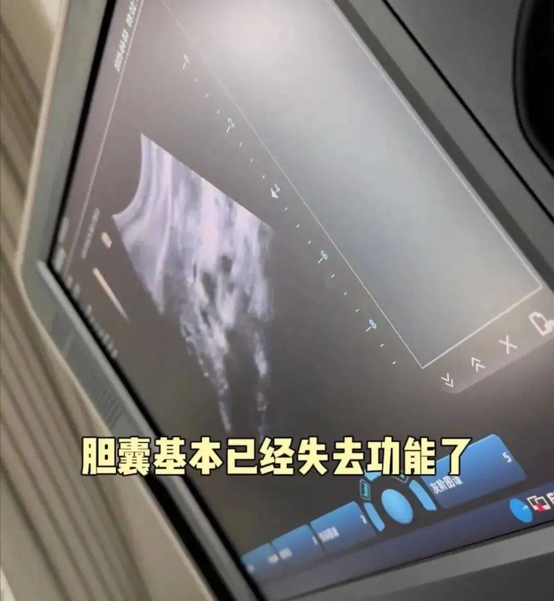 香港籃球投注
_36岁知名女演员确诊香港籃球投注
!“已基本失去功能”