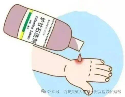 皇冠信用盘_西安多区发现隐翅虫?千万别拍皇冠信用盘!毒液堪比硫酸