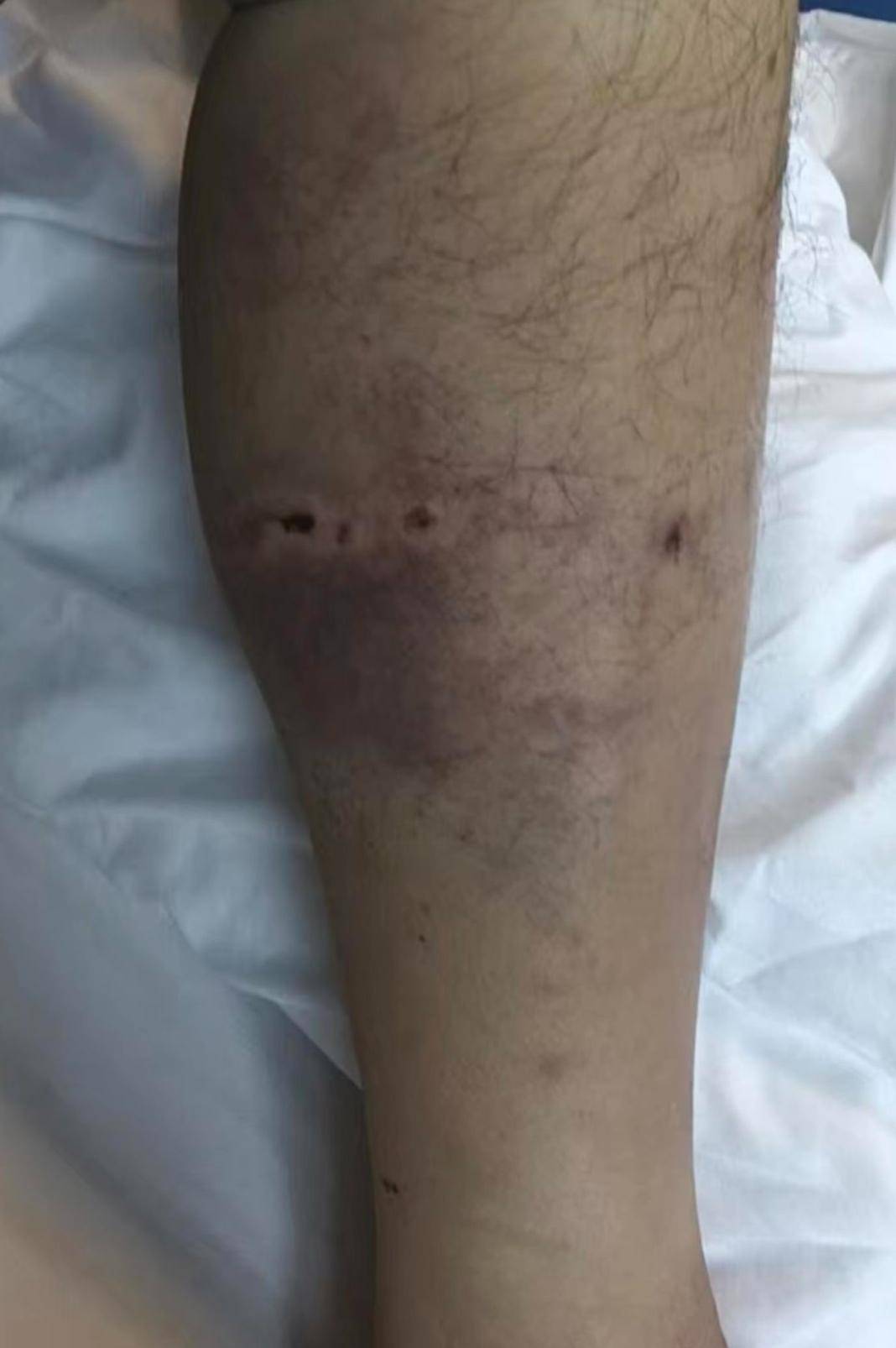 皇冠信用網开户_重庆一男子上山采菌后遇熊袭击皇冠信用網开户，幸亏穿了雨靴！20余名村民连夜救援